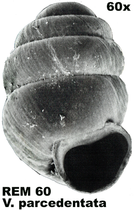 Vertigo parcedentata