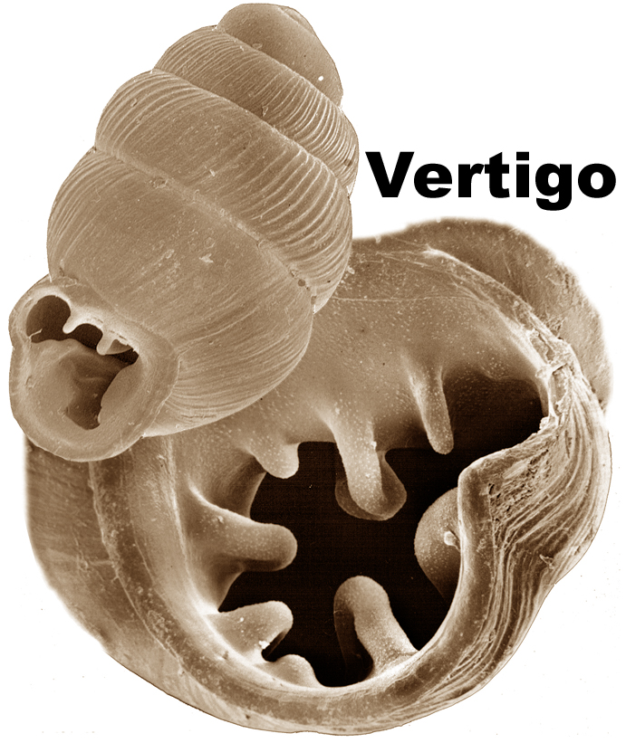 Vertigo